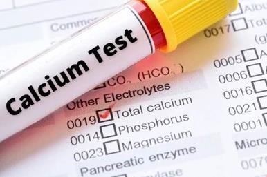 کلسیم خون چیست+ میزان نرمال کلسیم